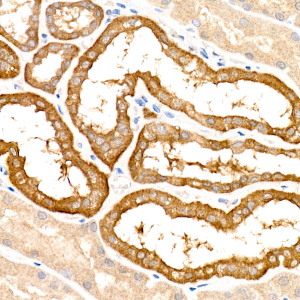 [KO Validated] KRAS Rabbit mAb