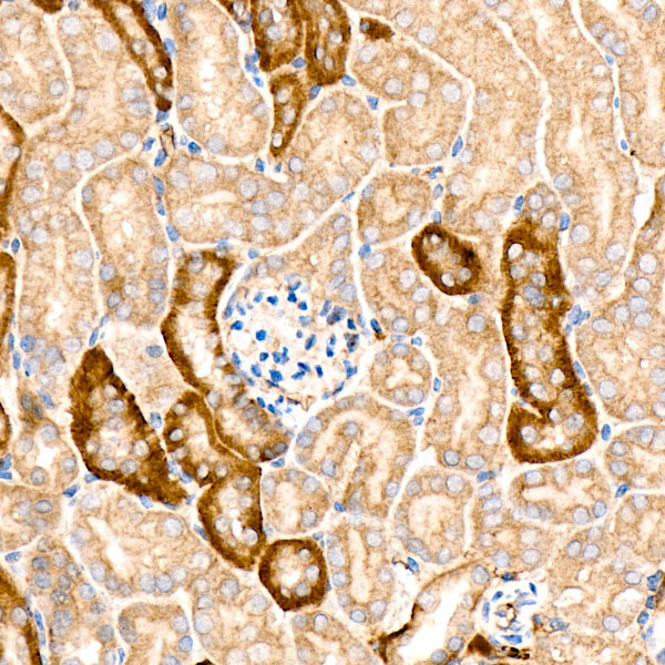 [KO Validated] KRAS Rabbit mAb