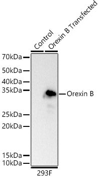 Orexin B Rabbit mAb