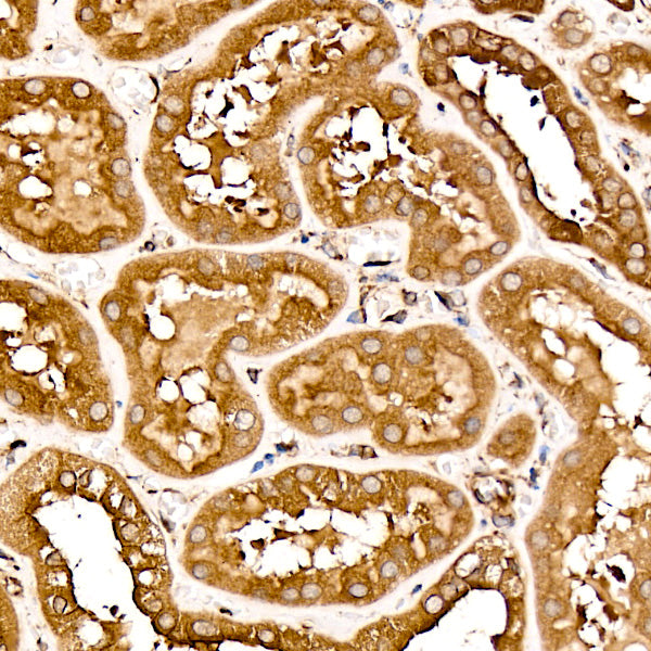 TRAF6 Rabbit mAb