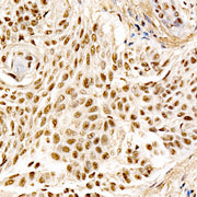 MDM2 Rabbit mAb
