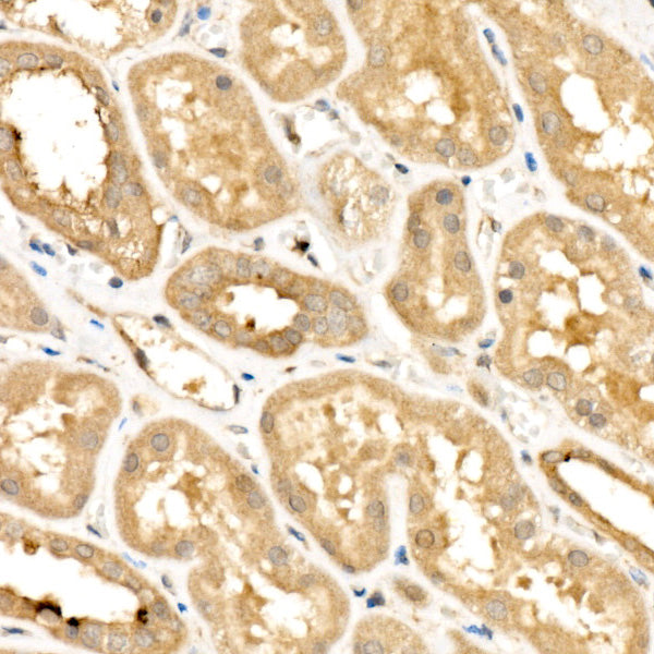 RELB Rabbit mAb