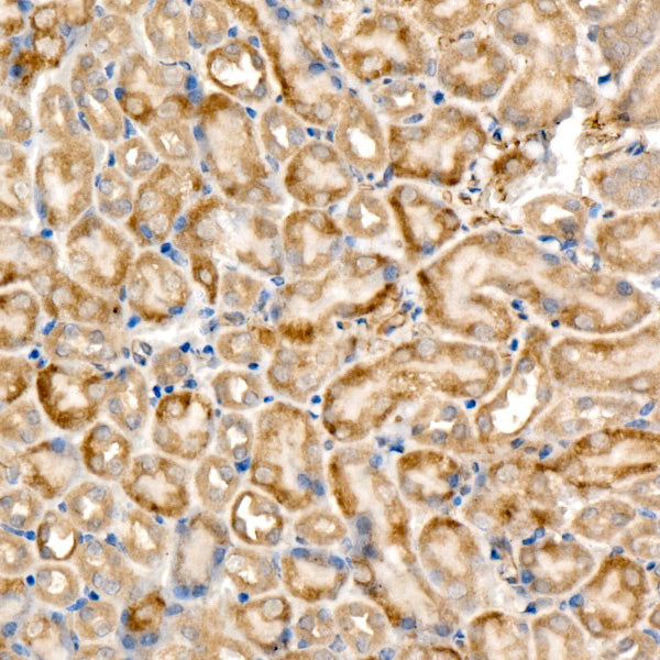 RELB Rabbit mAb