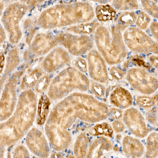 RELB Rabbit mAb