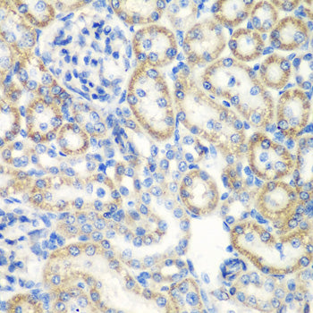 SMYD1 Rabbit pAb