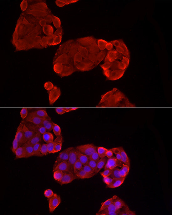 Glypican 3 (GPC3) Rabbit mAb
