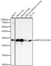 ANT2/SLC25A5 Rabbit mAb