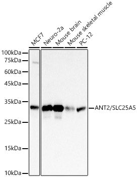 ANT2/SLC25A5 Rabbit mAb
