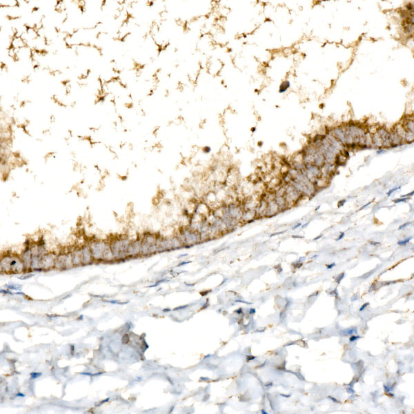 ANT2/SLC25A5 Rabbit mAb
