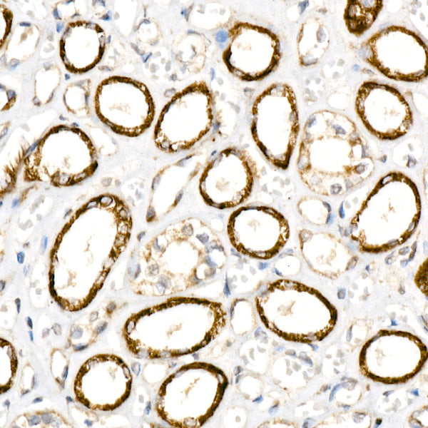 ANT2/SLC25A5 Rabbit mAb