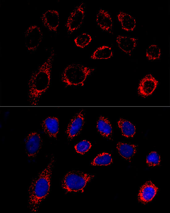 ANT2/SLC25A5 Rabbit mAb