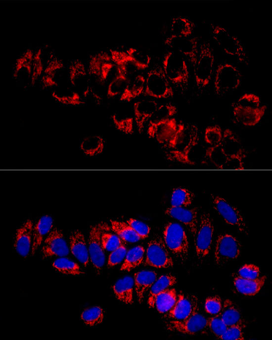 ANT2/SLC25A5 Rabbit mAb
