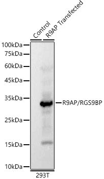 R9AP/RGS9BP Rabbit mAb