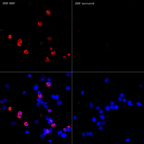 R9AP/RGS9BP Rabbit mAb