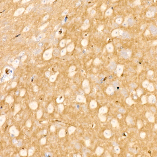 SMPD3/NSMase2 Rabbit mAb