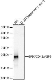 GPIX/CD42a/GP9 Rabbit mAb