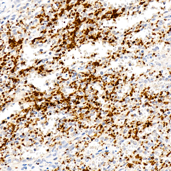 GPIX/CD42a/GP9 Rabbit mAb