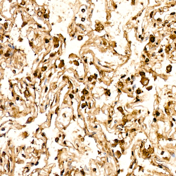 AGER Rabbit mAb