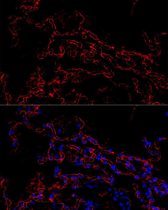 AGER Rabbit mAb