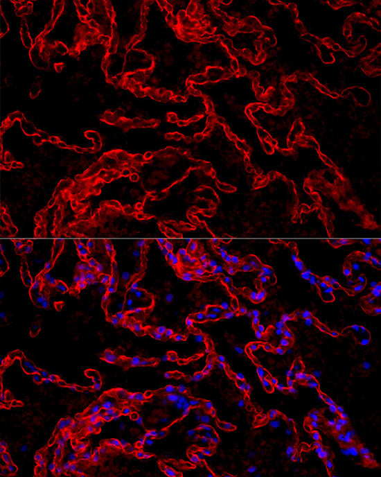 AGER Rabbit mAb