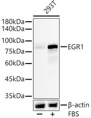 EGR1 Rabbit mAb