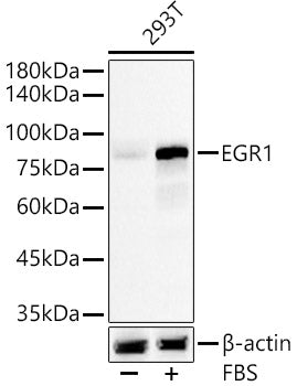 EGR1 Rabbit mAb