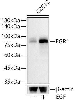 EGR1 Rabbit mAb