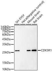 CDK5R1 Rabbit mAb