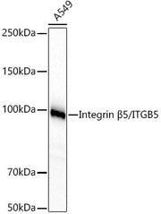 Integrin β5/ITGB5 Rabbit mAb