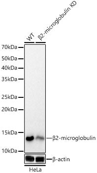 [KD Validated] beta 2 Microglobulin Rabbit mAb