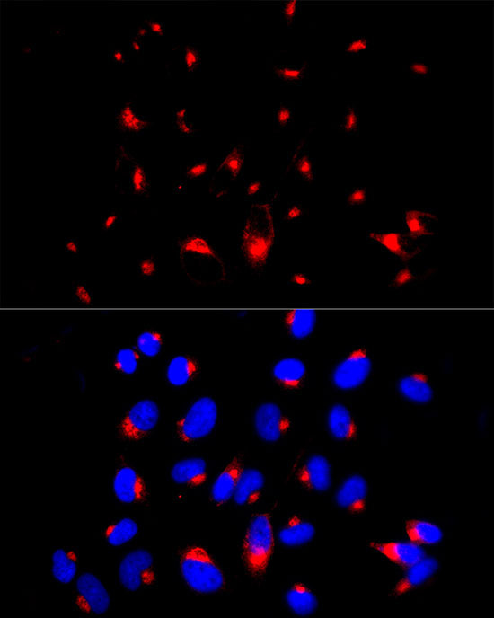 [KD Validated] beta 2 Microglobulin Rabbit mAb