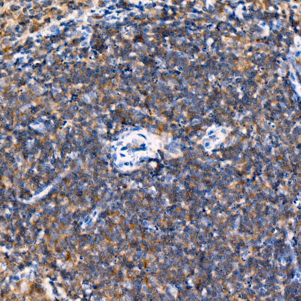 USP25 Rabbit mAb