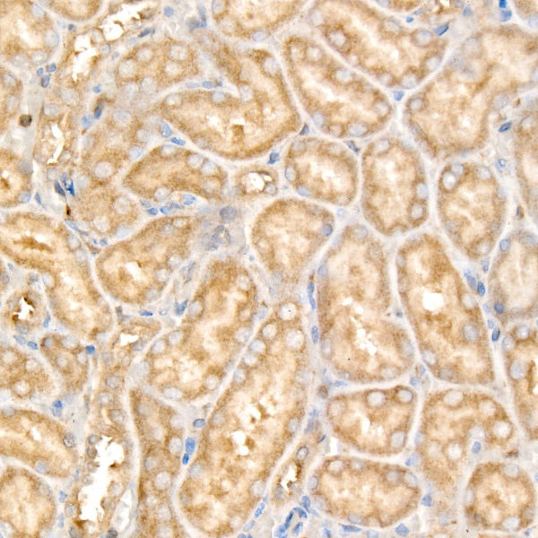 USP25 Rabbit mAb