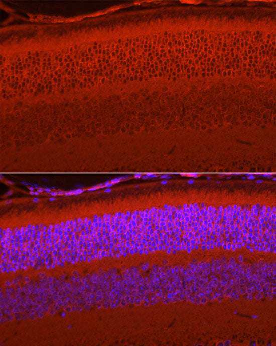 RPGR Rabbit mAb