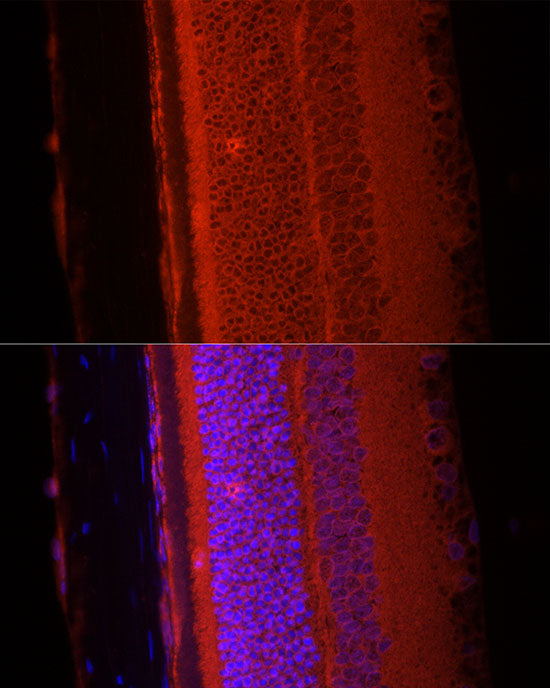 RPGR Rabbit mAb