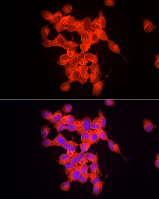 RPGR Rabbit mAb