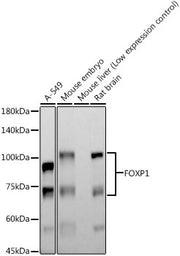FOXP1 Rabbit mAb