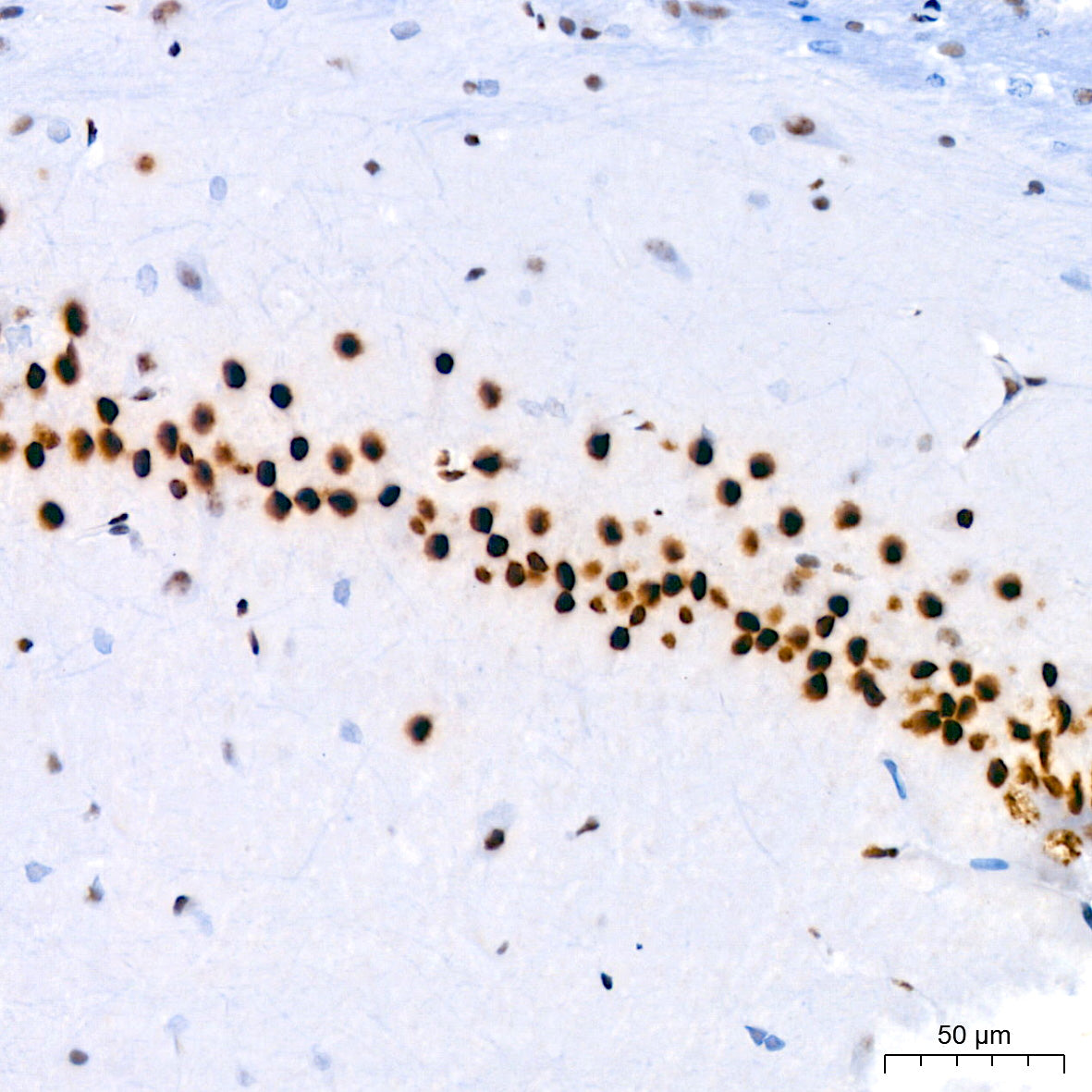 FOXP1 Rabbit mAb