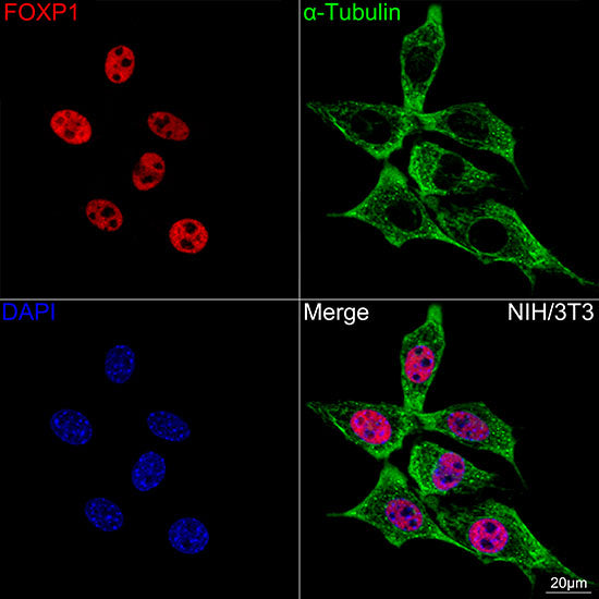 FOXP1 Rabbit mAb