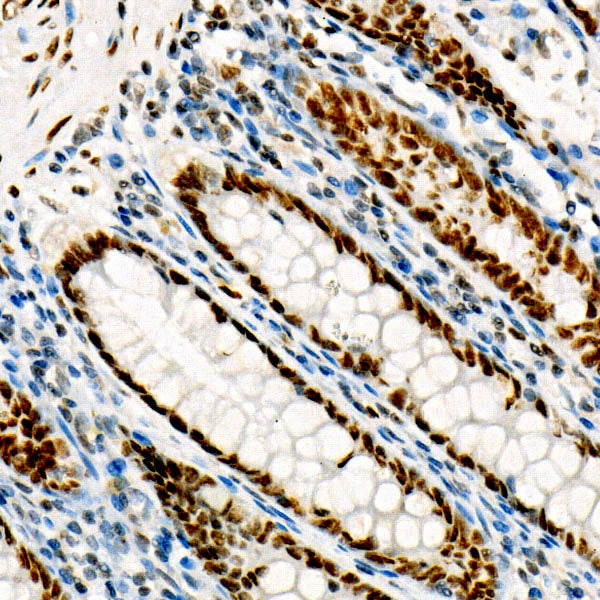 FOXP1 Rabbit mAb
