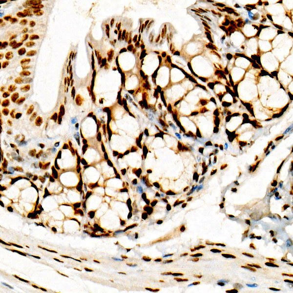 FOXP1 Rabbit mAb