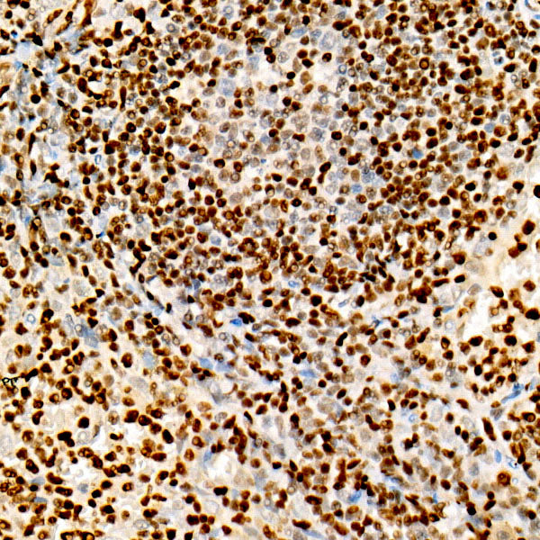 FOXP1 Rabbit mAb