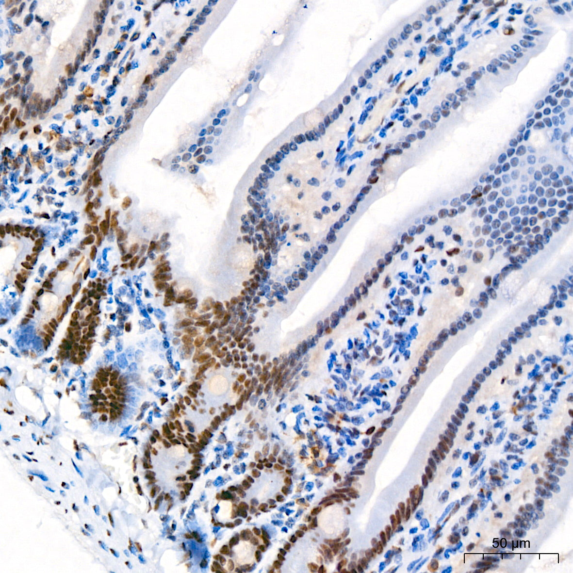 FOXP1 Rabbit mAb