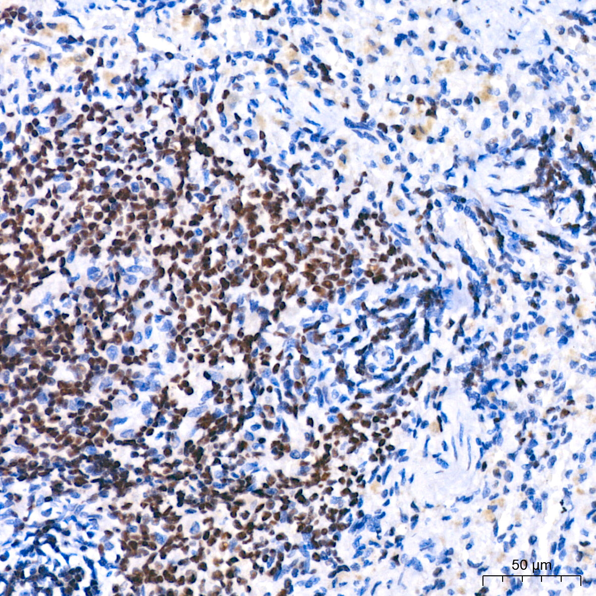 FOXP1 Rabbit mAb
