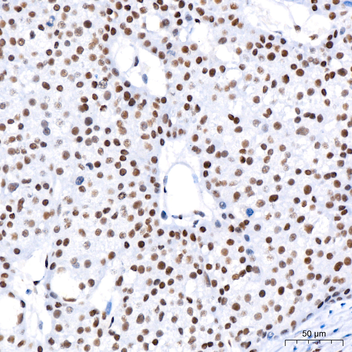 FOXP1 Rabbit mAb