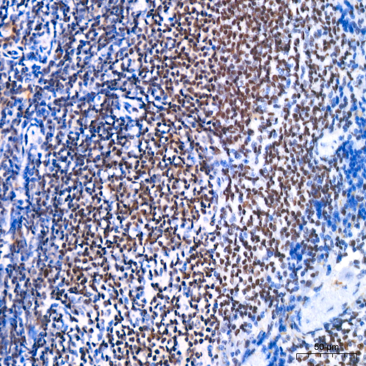 FOXP1 Rabbit mAb