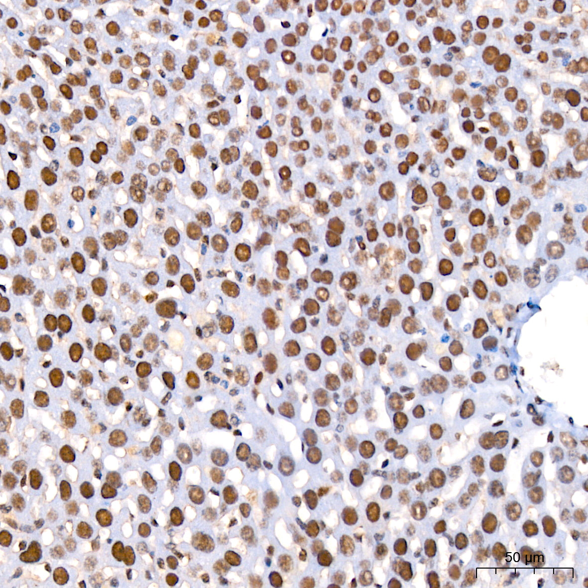 FOXP1 Rabbit mAb