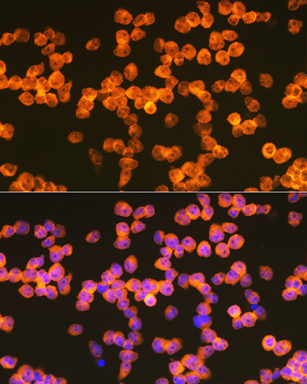 ZAP70 Rabbit mAb
