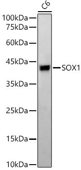 SOX1 Rabbit mAb