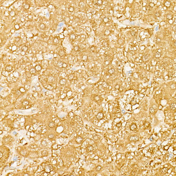 BHMT Rabbit mAb